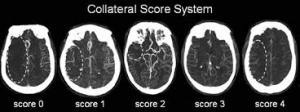 Collaterals