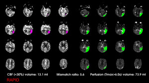 2_CT Perfusion image for Dr. Cardona