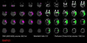 3_mr-rapid-output-for-dr-cardona